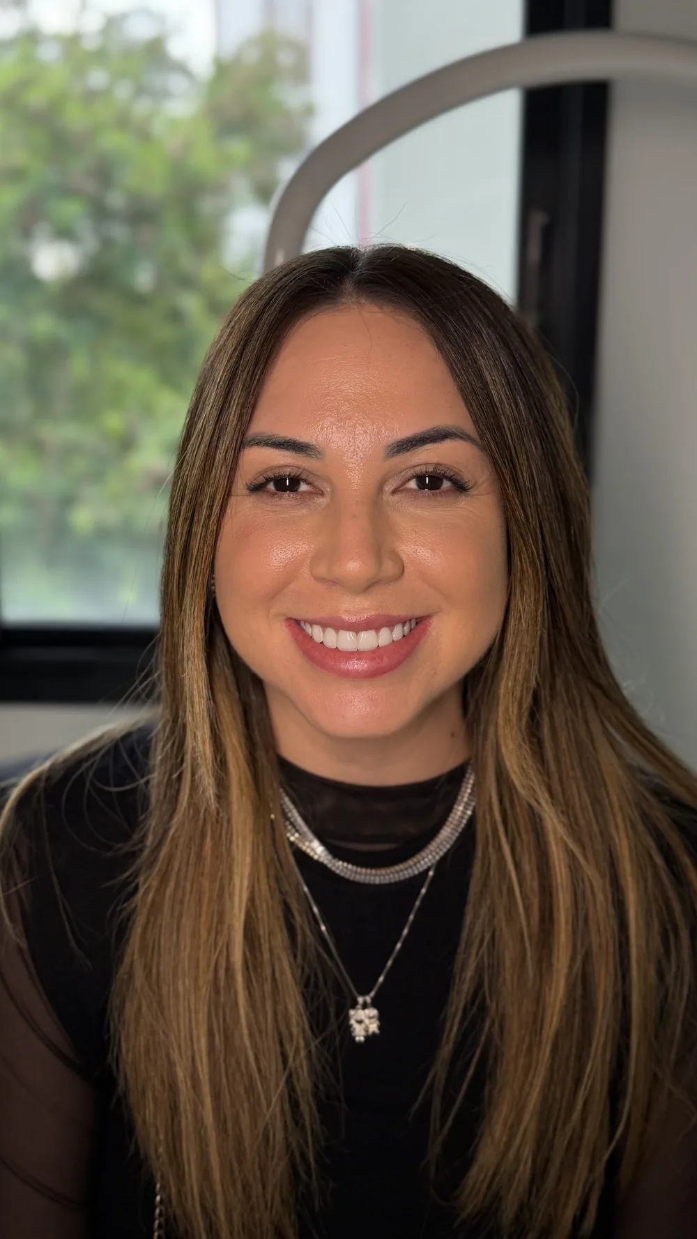Paciente após o tratamento de contorno facial